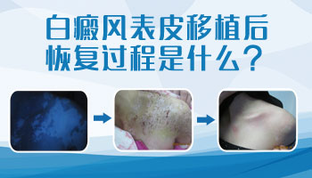 儿童腹部有白块一直扩散用什么方法控制