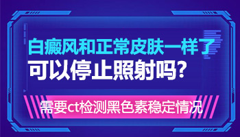 儿童眼处有白块中西医结合治疗怎么样