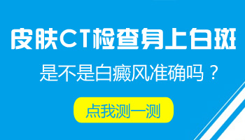 白癜风到底是能不能治好怎么吃药不管用