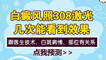 儿童腹部长白癜风照308好还是uvb效果好