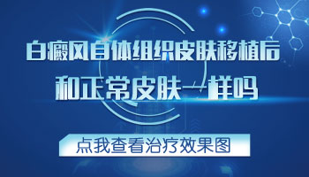 处在发展期的白斑用药恢复的快吗