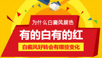 儿童脖颈有白斑一天照几次激光比较合适