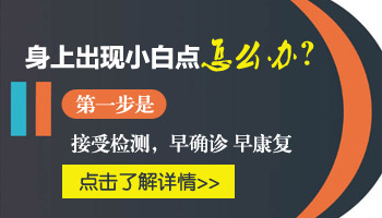 孩子身上有白点怎么用药好的快